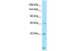 Western Blotting (WB) image for anti-Latent Transforming Growth Factor beta Binding Protein 4 (LTBP4) (C-Term) antibody (ABIN2789916)