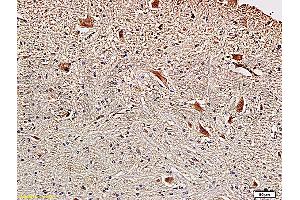 Formalin-fixed and paraffin embedded rat brainstem with Anti-Fascin1 Polyclonal Antibody, Unconjugated (ABIN728293) at 1:300, followed by conjugation to the secondary antibody and DAB staining (Fascin Antikörper  (AA 11-110))