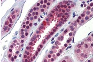 Human Kidney (formalin-fixed, paraffin-embedded) stained with NFX1 antibody ABIN462262 followed by biotinylated goat anti-rabbit IgG secondary antibody ABIN481713, alkaline phosphatase-streptavidin and chromogen. (NFX1 Antikörper  (C-Term))