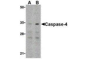 Western Blotting (WB) image for anti-Caspase 4, Apoptosis-Related Cysteine Peptidase (CASP4) (N-Term) antibody (ABIN2477914) (Caspase 4 Antikörper  (N-Term))