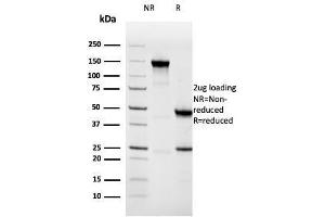 SDS-PAGE Analysis Purified Napsin A Mouse Monoclonal Antibody (NAPSA/3308). (NAPSA Antikörper  (AA 189-299))