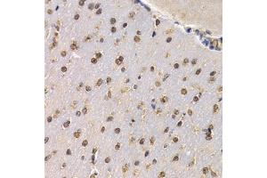 Immunohistochemistry of paraffin-embedded mouse brain using RAD1 antibody (ABIN5995531) at dilution of 1/200 (40x lens).