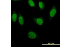 Immunofluorescence of monoclonal antibody to PRDM1 on HeLa cell. (PRDM1 Antikörper  (AA 422-493))