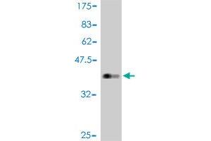 Western Blot detection against Immunogen (37 KDa) . (FOXO3 Antikörper  (AA 361-460))