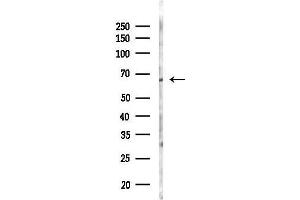 anti-IKAROS Family Zinc Finger 4 (Eos) (IKZF4) (C-Term) antibody