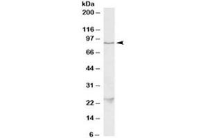 Western blot testing of HeLa lysate with TBK1 antibody at 1ug/ml. (TBK1 Antikörper)