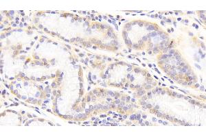 Immunohistochemistry (IHC) image for anti-Heparan Sulfate Proteoglycan 2 (HSPG2) (AA 4149-4391) antibody (ABIN7435115)