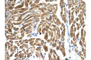 PEX10 antibody was used for immunohistochemistry at a concentration of 4-8 ug/ml to stain Skeletal muscle cells (arrows) in Human Muscle. (PEX10 Antikörper  (Middle Region))