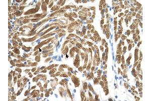 PEX10 antibody was used for immunohistochemistry at a concentration of 4-8 ug/ml to stain Skeletal muscle cells (arrows) in Human Muscle.