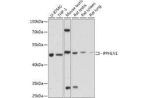 Western blot analysis of extracts of various cell lines, using PPHLN1 antibody (ABIN7269229) at 1:1000 dilution. (PPHLN1 Antikörper  (AA 195-255))