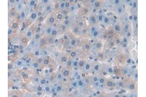 DAB staining on IHC-P; Samples: Rat Liver Tissue (RANKL Antikörper  (AA 106-240))