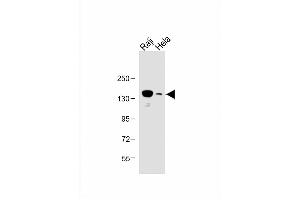 All lanes : Anti-UBE4B Antibody (N-term) at 1:1000 dilution Lane 1: Raji whole cell lysate Lane 2: Hela whole cell lysate Lysates/proteins at 20 μg per lane. (UBE4B Antikörper  (N-Term))