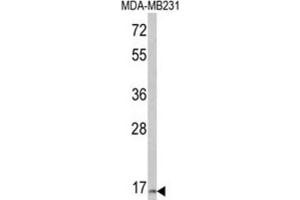 Western Blotting (WB) image for anti-Thyroid Stimulating Hormone, beta (TSHB) antibody (ABIN3003835)
