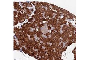 Immunohistochemical staining of human pancreas with TRAPPC6A polyclonal antibody  shows strong cytoplasmic positivity in exocrine glandular cells. (TRAPPC6A Antikörper)