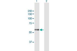 Western Blot analysis of CARD14 expression in transfected 293T cell line by CARD14 MaxPab polyclonal antibody.