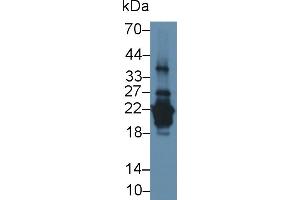 Detection of PRH2 in Human Saliva using Polyclonal Antibody to Acidic Salivary Proline Rich Phosphoprotein 2 (PRH2) (PRH2 Antikörper  (AA 17-166))
