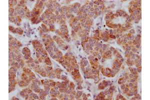 Immunohistochemistry (IHC) image for anti-Activin A Receptor, Type IIB (ACVR2B) antibody (ABIN7127321)