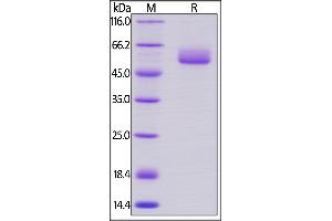 SDS-PAGE (SDS) image for Frizzled Family Receptor 2 (FZD2) (AA 24-190) protein (Fc Tag) (ABIN5674627)