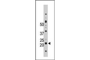 The NME4 polyclonal antibody  is used in Western blot to detect NME4 in Jurkat cell lysate. (NME4 Antikörper  (C-Term))
