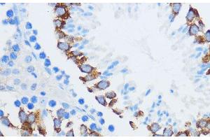 Immunohistochemistry of paraffin-embedded Mouse testis using IGF2BP3 Polyclonal Antibody at dilution of 1:100 (40x lens). (IGF2BP3 Antikörper)