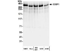 Western Blotting (WB) image for anti-Tumor Protein P53 Binding Protein 1 (TP53BP1) (AA 350-400) antibody (ABIN7453568)