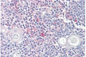 Anti-LITAF antibody IHC staining of human thymus. (LITAF Antikörper  (AA 51-64))