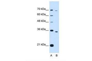 Image no. 1 for anti-PHD Finger Protein 6 (PHF6) (AA 152-201) antibody (ABIN321840) (PHF6 Antikörper  (AA 152-201))