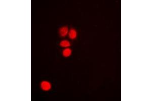 Immunofluorescent analysis of p53 staining in HeLa cells. (p53 Antikörper  (C-Term))