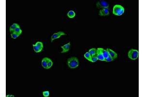 Immunofluorescent analysis of MCF-7 cells using ABIN7153609 at dilution of 1:100 and Alexa Fluor 488-congugated AffiniPure Goat Anti-Rabbit IgG(H+L) (GJB2 Antikörper  (AA 99-131))