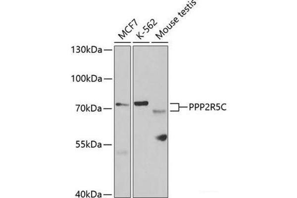 PPP2R5C Antikörper
