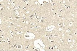Immunohistochemistry (IHC) image for anti-Leucine-Rich Repeat Containing G Protein-Coupled Receptor 5 (LGR5) (AA 443-473) antibody (ABIN389219)
