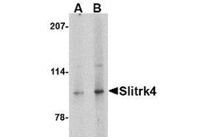 Image no. 1 for anti-SLIT and NTRK-Like Family, Member 4 (SLITRK4) (C-Term) antibody (ABIN1492201) (SLITRK4 Antikörper  (C-Term))