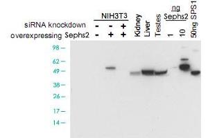 Western blot using Sephs2 polyclonal antibody  shows detection of Sephs2 in NIH/3T3 cells over-expressing this protein. (SEPHS2 Antikörper)