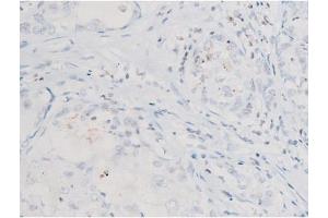 Immunohistochemistry (IHC) image for anti-Spleen tyrosine Kinase (SYK) (pTyr525) antibody (ABIN6255944)