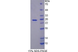 Image no. 1 for Crystallin, gamma F (CRYGF) (AA 1-173) protein (His tag) (ABIN6238427)