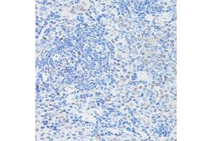 Immunohistochemistry of paraffin-embedded rat spleen using CASP3 antibody. (Caspase 3 Antikörper  (AA 55-160))