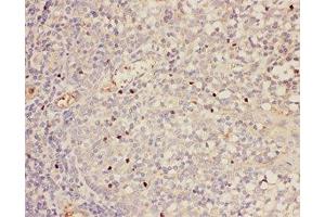 IHC-P: FOXP3 antibody testing of human tonsil tissue (FOXP3 Antikörper  (AA 101-431))