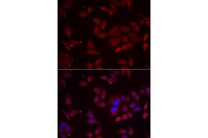 Immunofluorescence analysis of U2OS cells using PFKFB3 antibody (ABIN5974173). (PFKFB3 Antikörper)