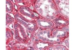 Immunohistochemistry (IHC) image for anti-Collagen, Type IV (COL4) (C-Term) antibody (ABIN2470570)