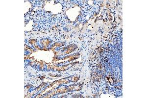 IHC analysis of RAB7/RAB7A using anti-RAB7/RAB7A antibody (ABIN7600597).