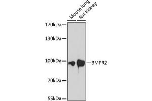 Western Blotting (WB) image for anti-Bone Morphogenetic Protein Receptor, Type II (serine/threonine Kinase) (BMPR2) (AA 27-150) antibody (ABIN7265906)