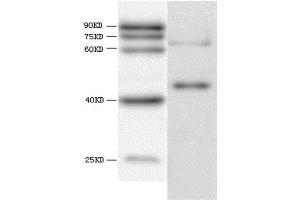WB analysis of recombinant Hepatitis E virus ORF 3, using HEV ORF3 antibody. (HEV ORF3 Antikörper  (AA 34-123))