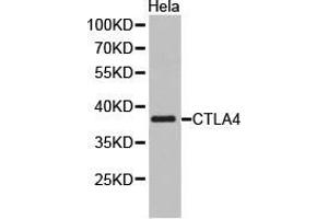 Western Blotting (WB) image for anti-Cytotoxic T-Lymphocyte-Associated Protein 4 (CTLA4) antibody (ABIN1872073) (CTLA4 Antikörper)