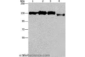 Western blot analysis of Hela, 293T, Raji and 231 cell, using GTF2I Polyclonal Antibody at dilution of 1:400 (GTF2I Antikörper)