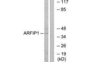 Western blot analysis of extracts from Jurkat cells, using ARFIP1 antibody. (ARFIP1 Antikörper)