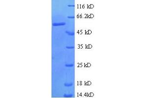 SDS-PAGE (SDS) image for Zinc Finger Protein 384 (ZNF384) (AA 1-245), (partial) protein (GST tag) (ABIN5712293)