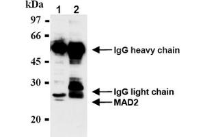 Western Blotting (WB) image for anti-MAD2 Mitotic Arrest Deficient-Like 1 (Yeast) (MAD2L1) antibody (ABIN567786) (MAD2L1 Antikörper)