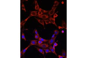 Immunofluorescence analysis of NIH/3T3 cells using IR antibody (ABIN6130497, ABIN6142514, ABIN6142515 and ABIN6216327) at dilution of 1:100. (IRAK1 Antikörper  (AA 424-633))