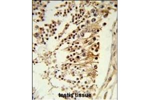 Formalin-fixed and paraffin-embedded human testis tissue reacted with CENPH Antibody (Center), which was peroxidase-conjugated to the secondary antibody, followed by DAB staining. (CENPH Antikörper  (AA 136-162))