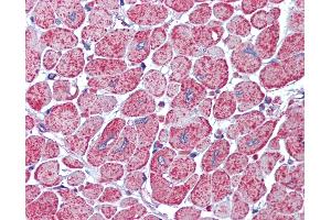 Anti-AKT antibody IHC of human heart. (AKT1/2 Antikörper)